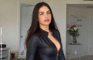 Tras pesadilla por biopolímeros, Jessica Cediel presume su cola
