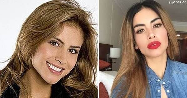 Antes y después Jessica Cediel para ilustrar Así quedaron las cirugías de famosas colombianas, ¡increíbles!