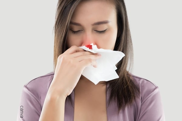 Foto de mujer limpiándose sangre de la nariz.