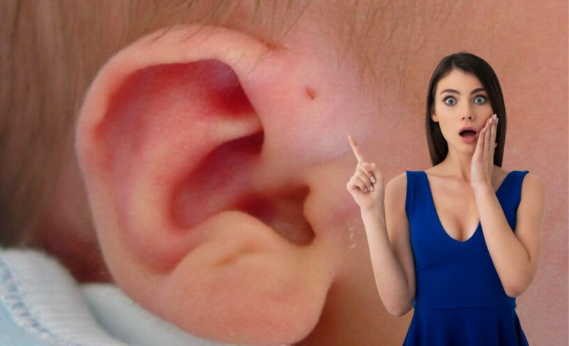 Agujero en la oreja