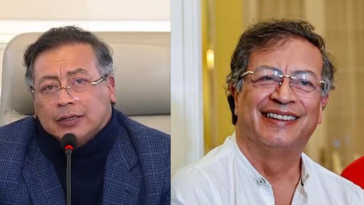 Gustavo Petro se realizó una cirugía