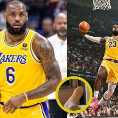 como se ven los pies de LeBron James