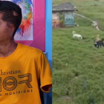 joven atacado por manada de perros cuenta cómo fue el suceso