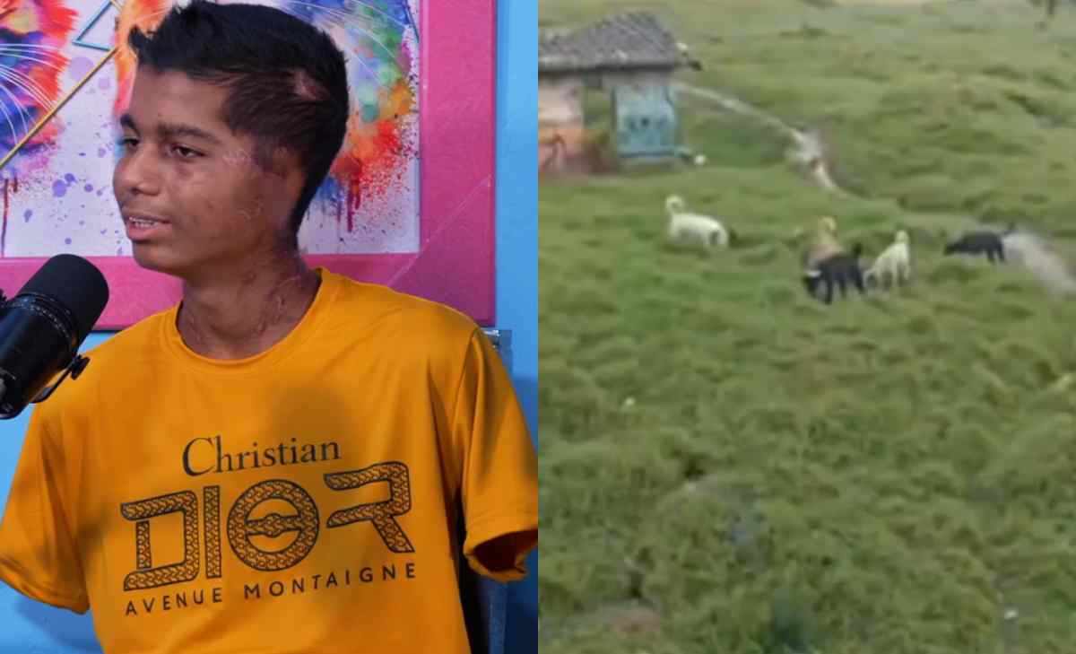 joven atacado por manada de perros cuenta cómo fue el suceso