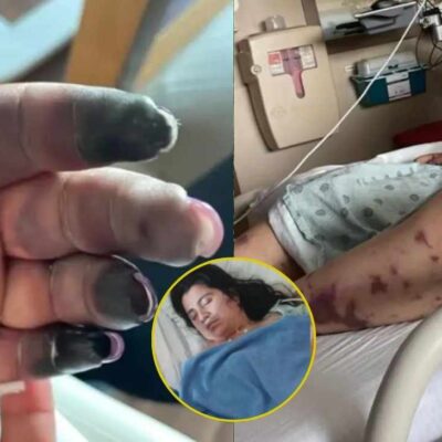 Una joven colombiana de 27 años, enfrenta una grave infección en EE. UU