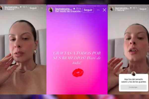 Laura Acuña reveló que atraviesa un delicado momento de salud