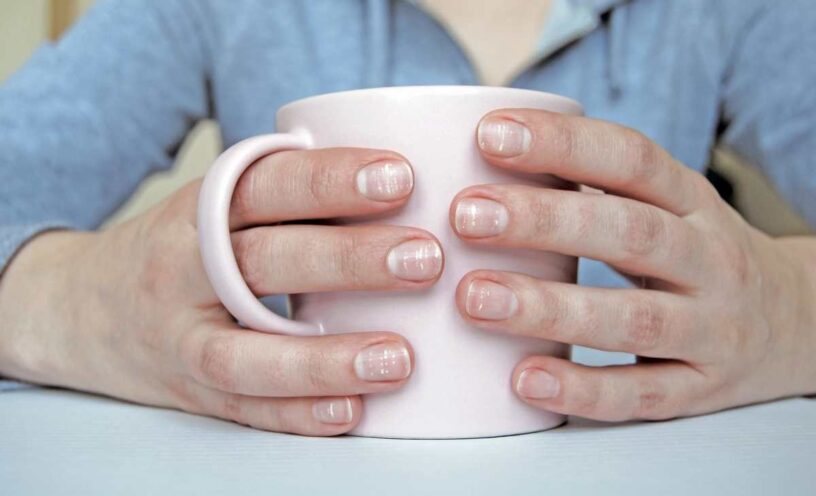 qué significan las manchas blancas en las uñas.