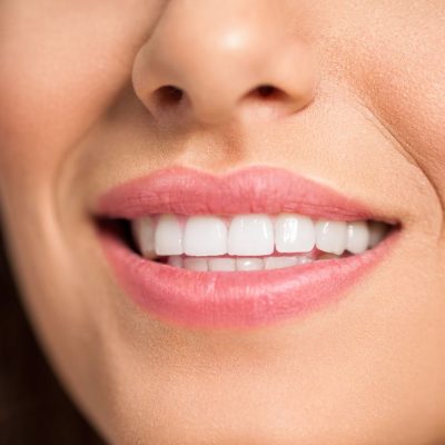 ¿Qué significa soñar con dientes? ¡Algo muy fuerte!
