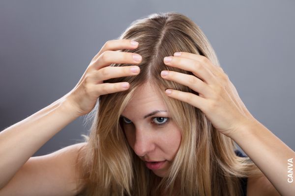 Foto de mujer mirándose el cuero cabelludo.