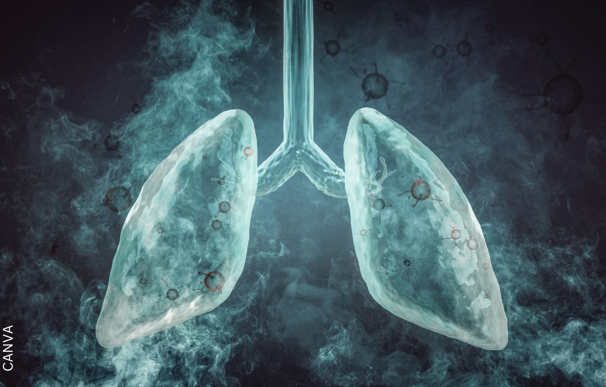 Remedios caseros para limpiar los pulmones de un fumador