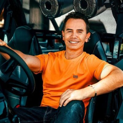 resultados de procedimiento estético de Jhonny Rivera