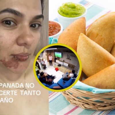 Video de la mujer que se le explotó una empanada mientras se la comía: Sufrió graves quemaduras