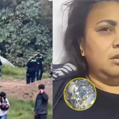 Marcas en el cuerpo de Yulia Toloza