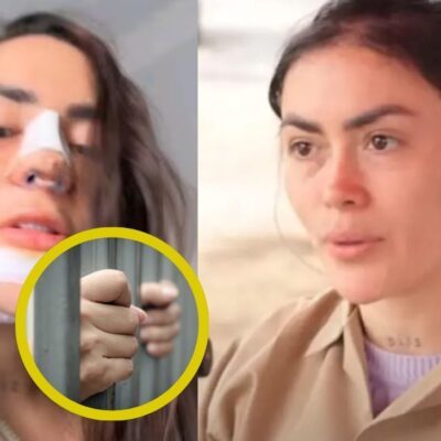 La foto del informe que revela que Epa Colombia se aplicó relleno de labios y glúteos dentro de la cárcel