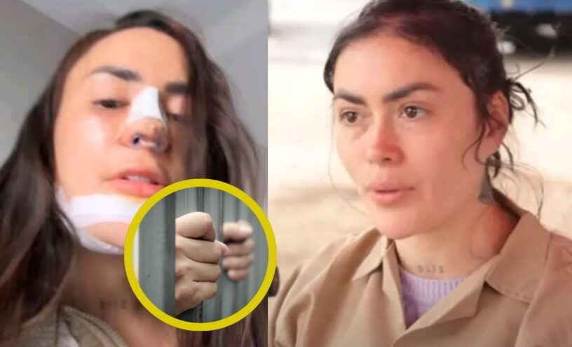 La foto del informe que revela que Epa Colombia se aplicó relleno de labios y glúteos dentro de la cárcel