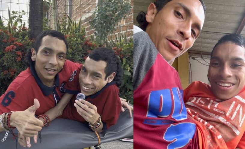 Murieron los hermanos siameses José Luis y José Armando Cevallos